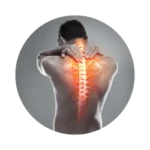 Cervical Pain